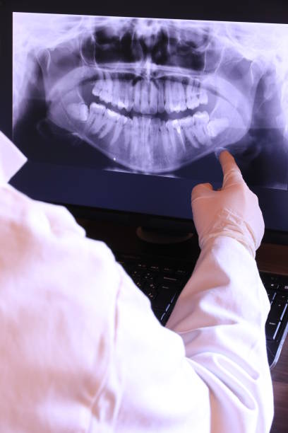 Best Emergency Gum Treatment in Ashland, NE