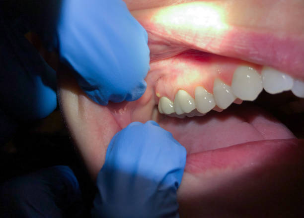 Best Weekend Emergency Dentist in Ashland, NE